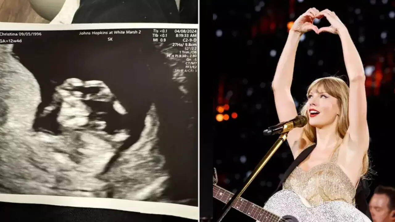 Sonogram shows baby mimicking Taylor