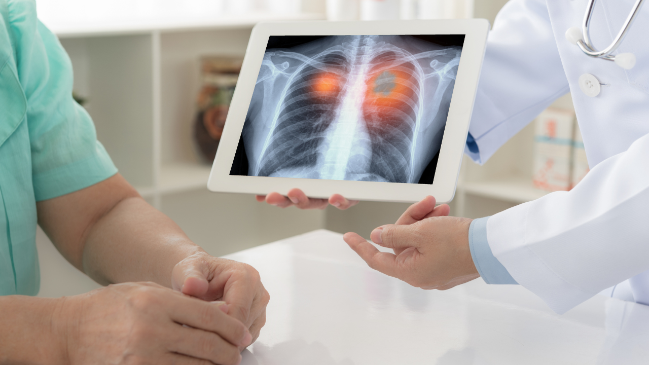 lung (29)