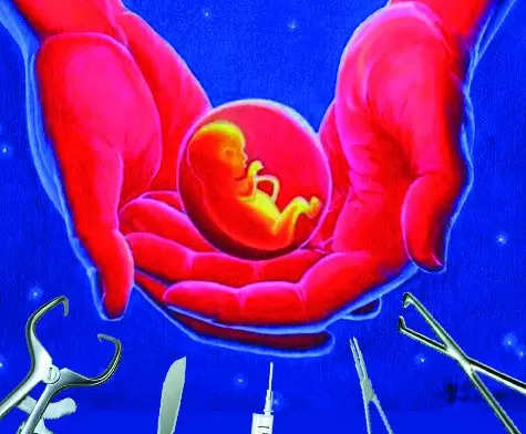 Illegal abortion racket unearthed in Kittur taluk