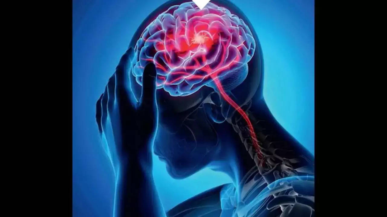 In coma for 2 months & ICU for 4, Delhi man recovers after multiple brain strokes