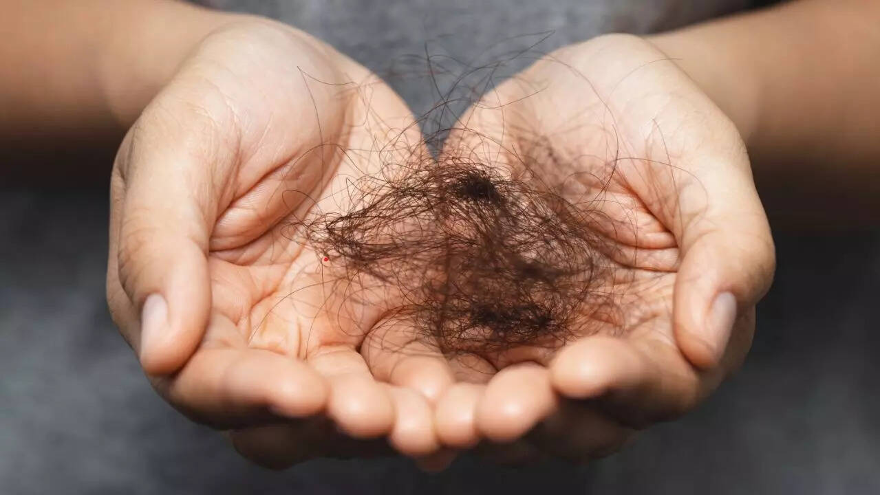 hair fall 2