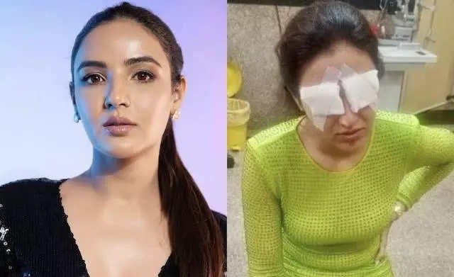 Jasmine Bhasin shares health update post-her corneal damage; says, “I’m out of the danger zone”