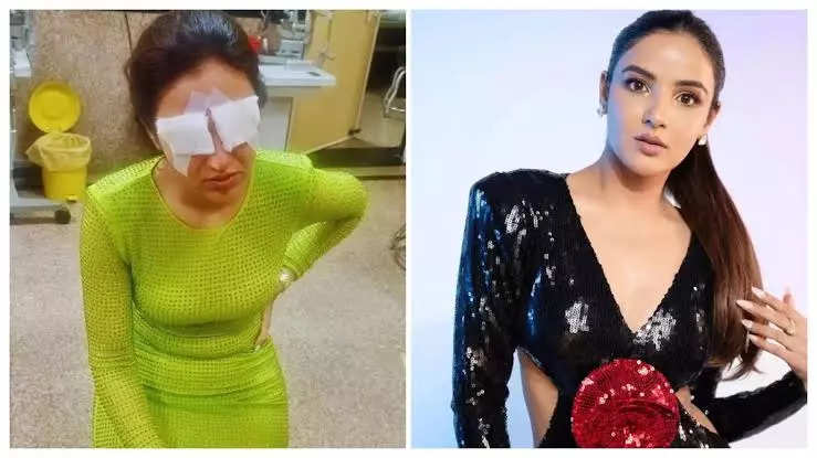 Jasmine Bhasin shares eye recovery update after corneal damage from lenses; says, “Bilkul achi hun..”
