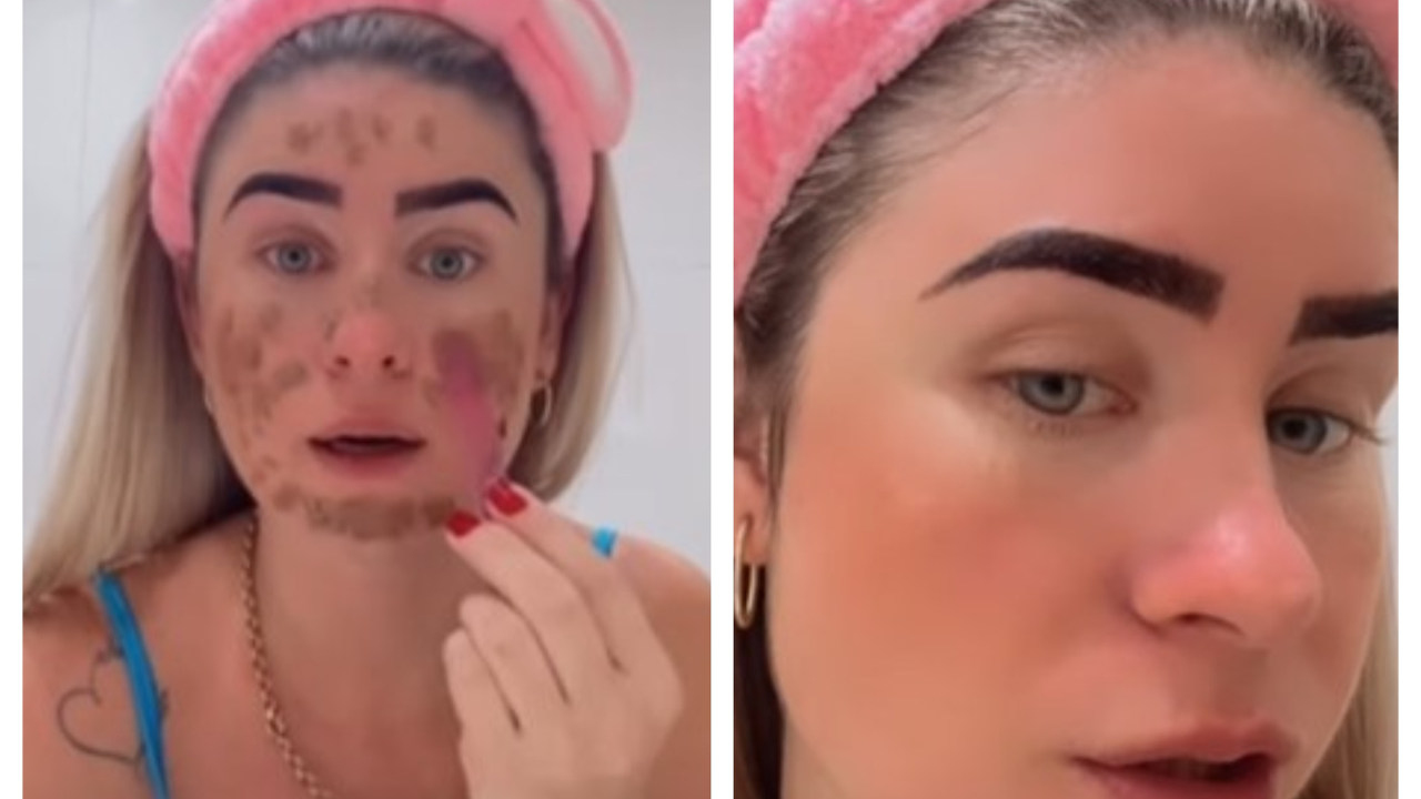 No science behind: Brazilian influencer's poop face mask draws flak from doctors