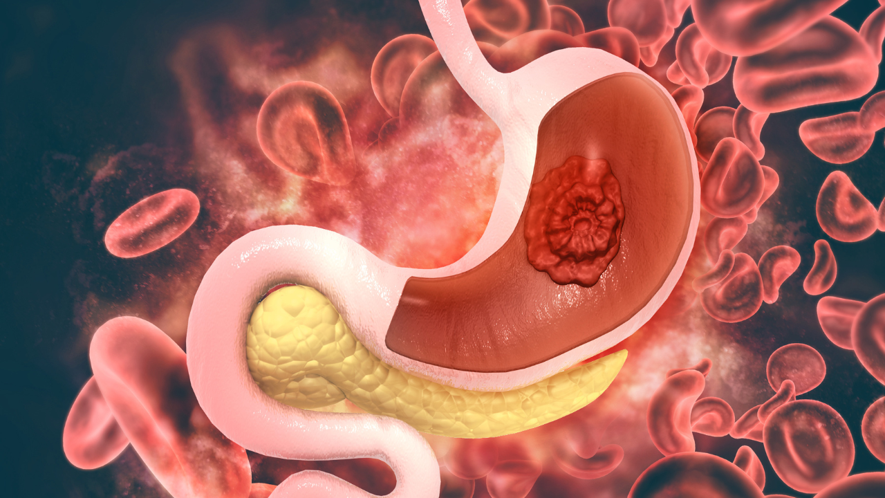 stomach (12)