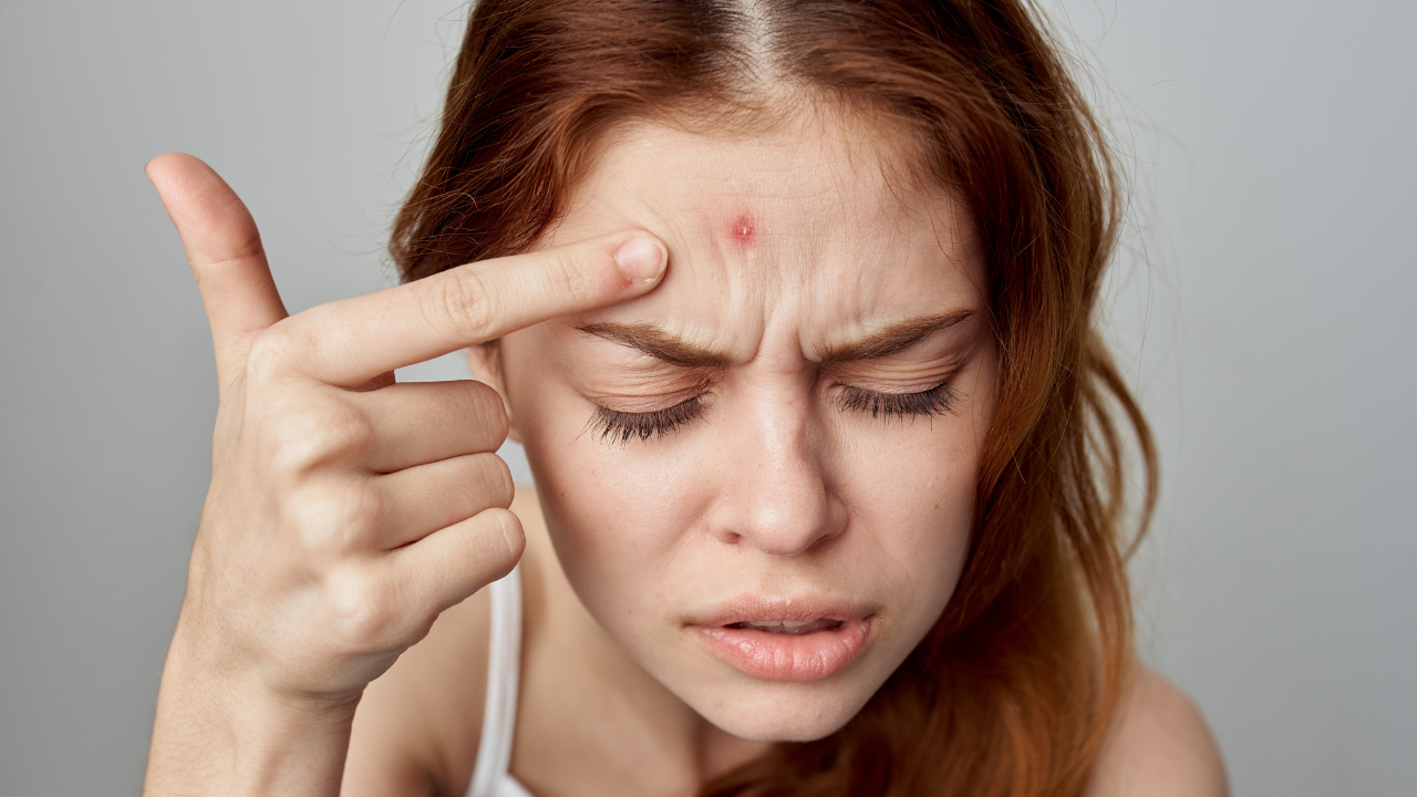 7 areas of face pimples that indicate health issues