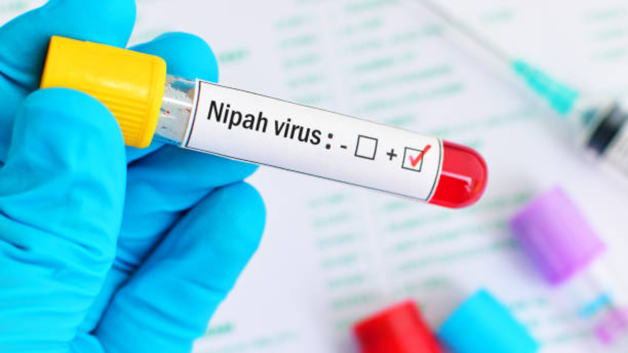 Student dies of Nipah virus in Kerala