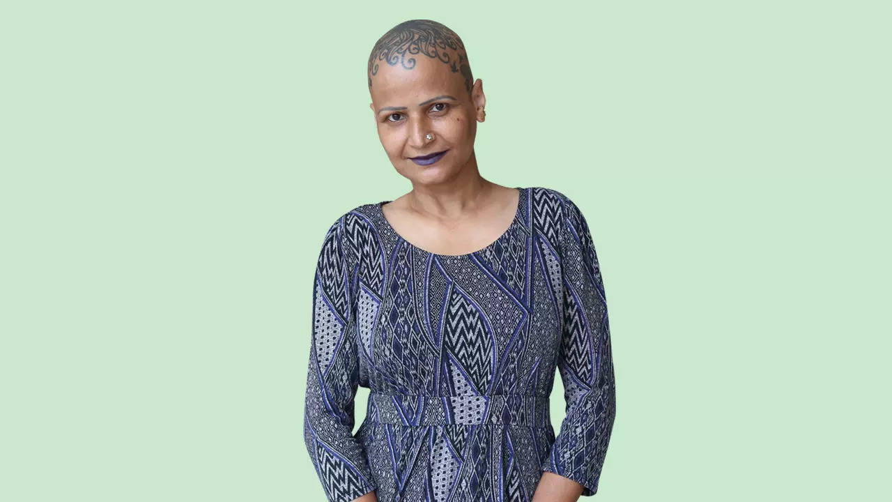 Rocking the bald look: This alopecia survivor refuses to hide behind a wig