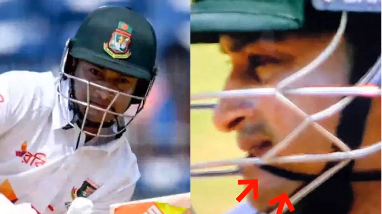 EXPLAINED: Why Shakib has a band between his teeth while batting