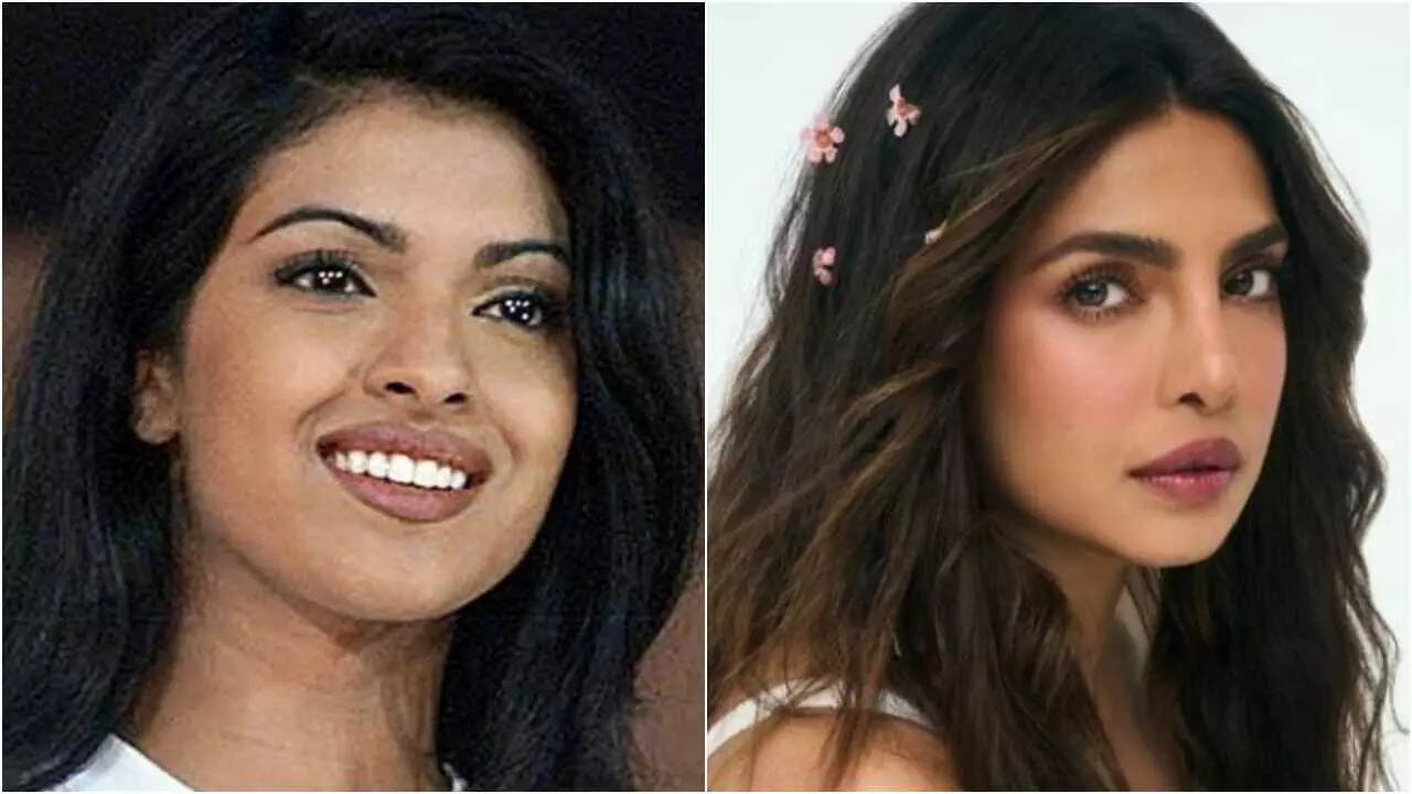 Surgery gone wrong: Priyanka’s honest confession