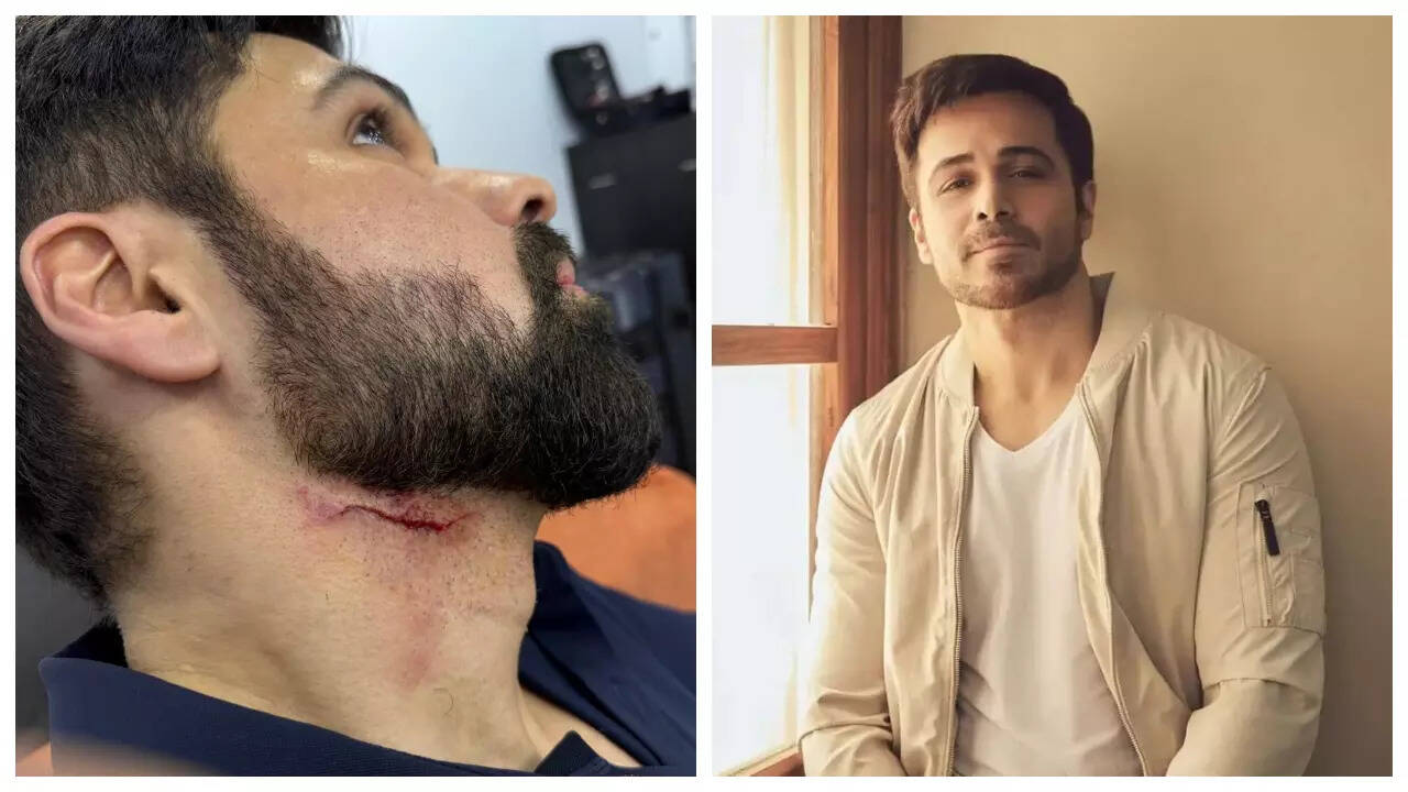 Emraan Hashmi injured on 'Goodachari2' set