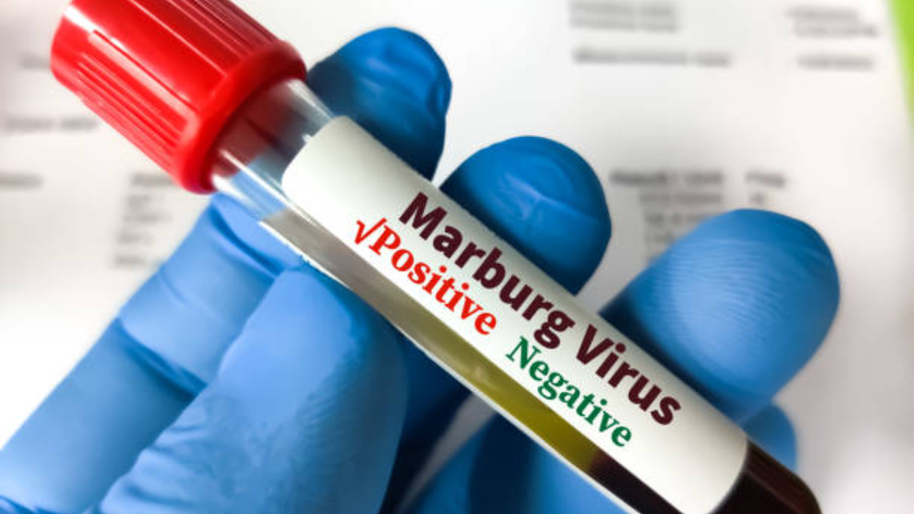 US CDC to release second-highest warning level for Marburg virus