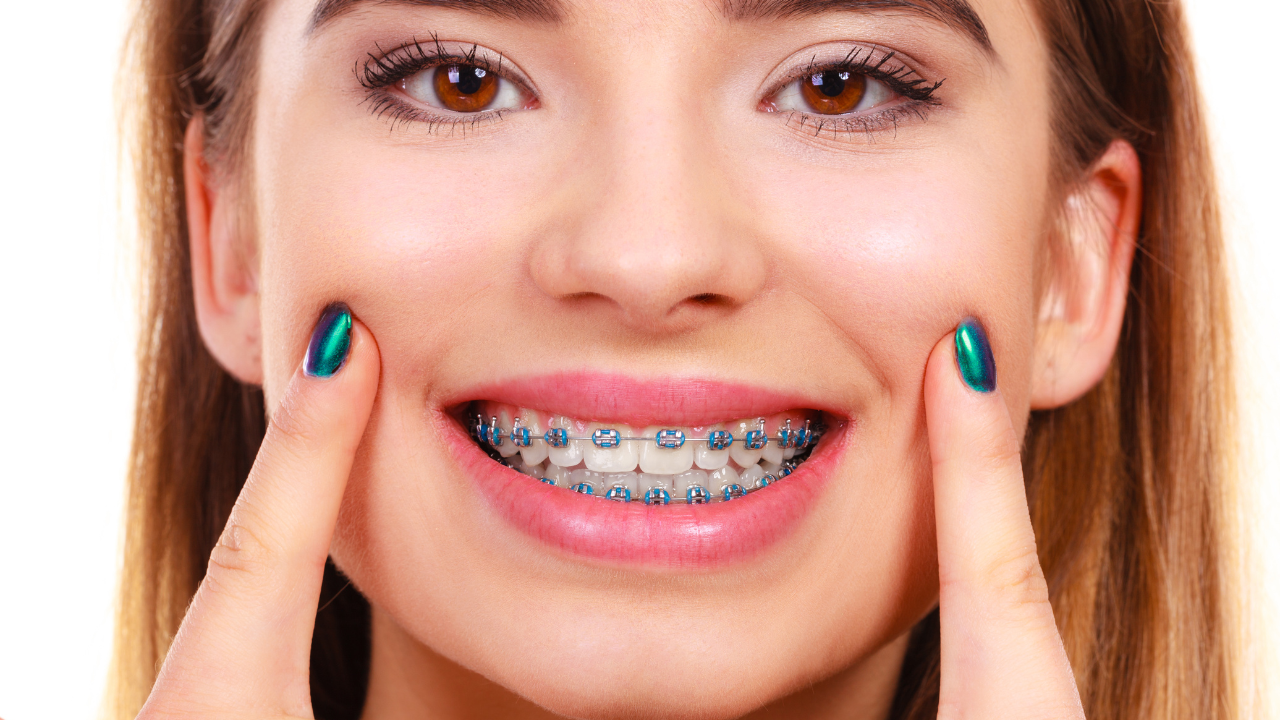 How to properly care for your braces ?