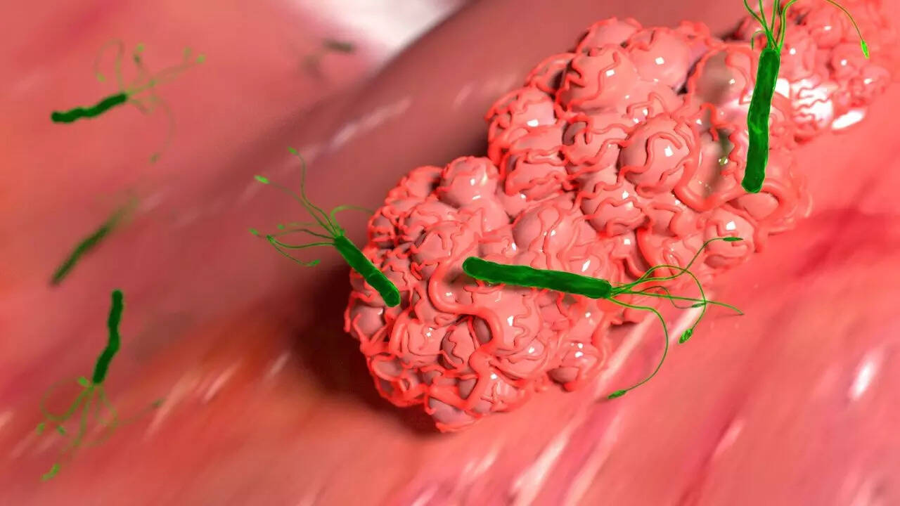 tumour