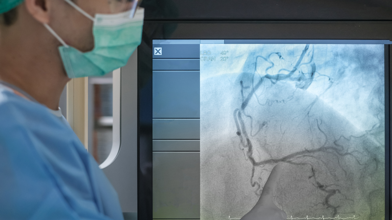 Do you need an Angiogram? Signs and symptoms that lead to this test