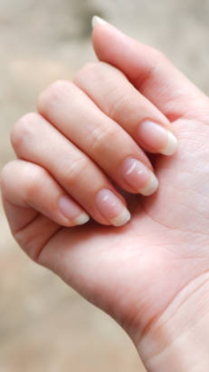 Nails can show signs of illness: Here's how thumbnail