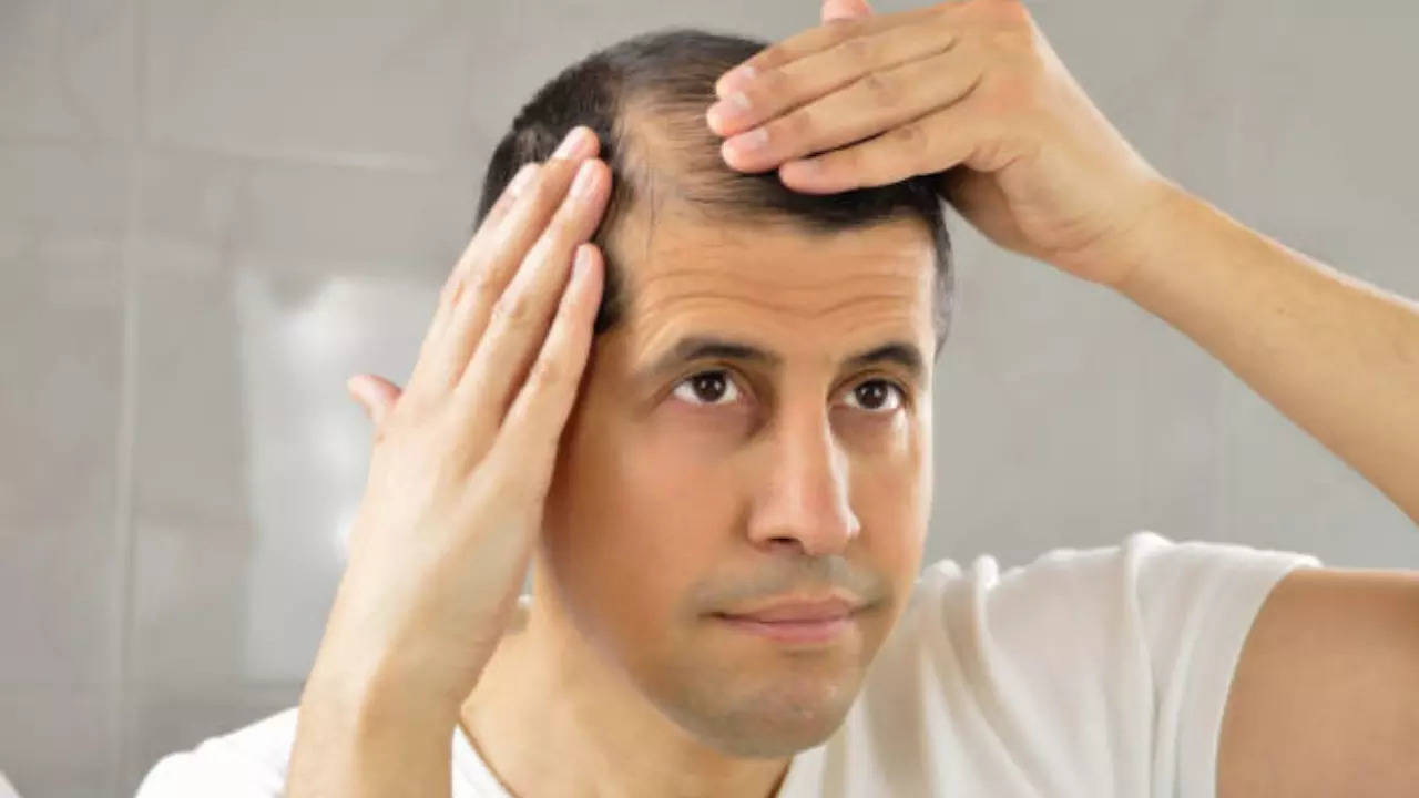 Ayurvedic oil to grow hair in bald patches