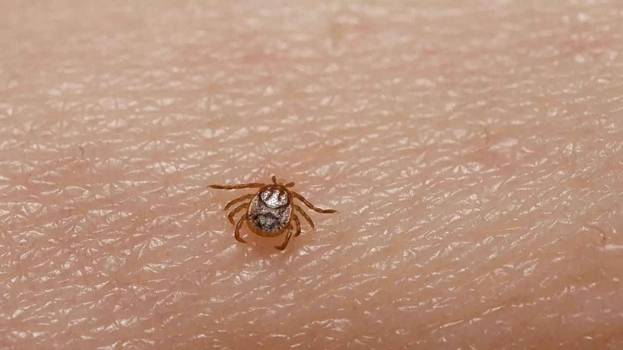 3 die from tick bite disease in California: All about the Rocky Mountain spotted fever