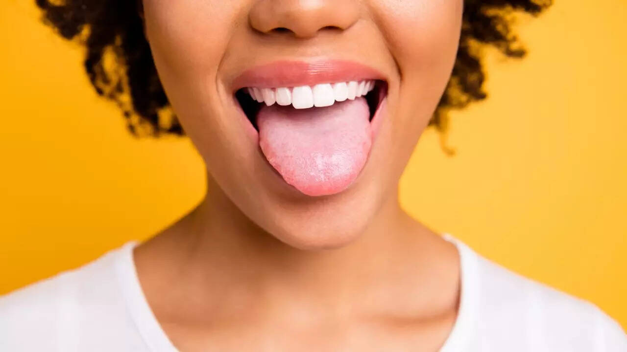 Dad tongue cancer (2)