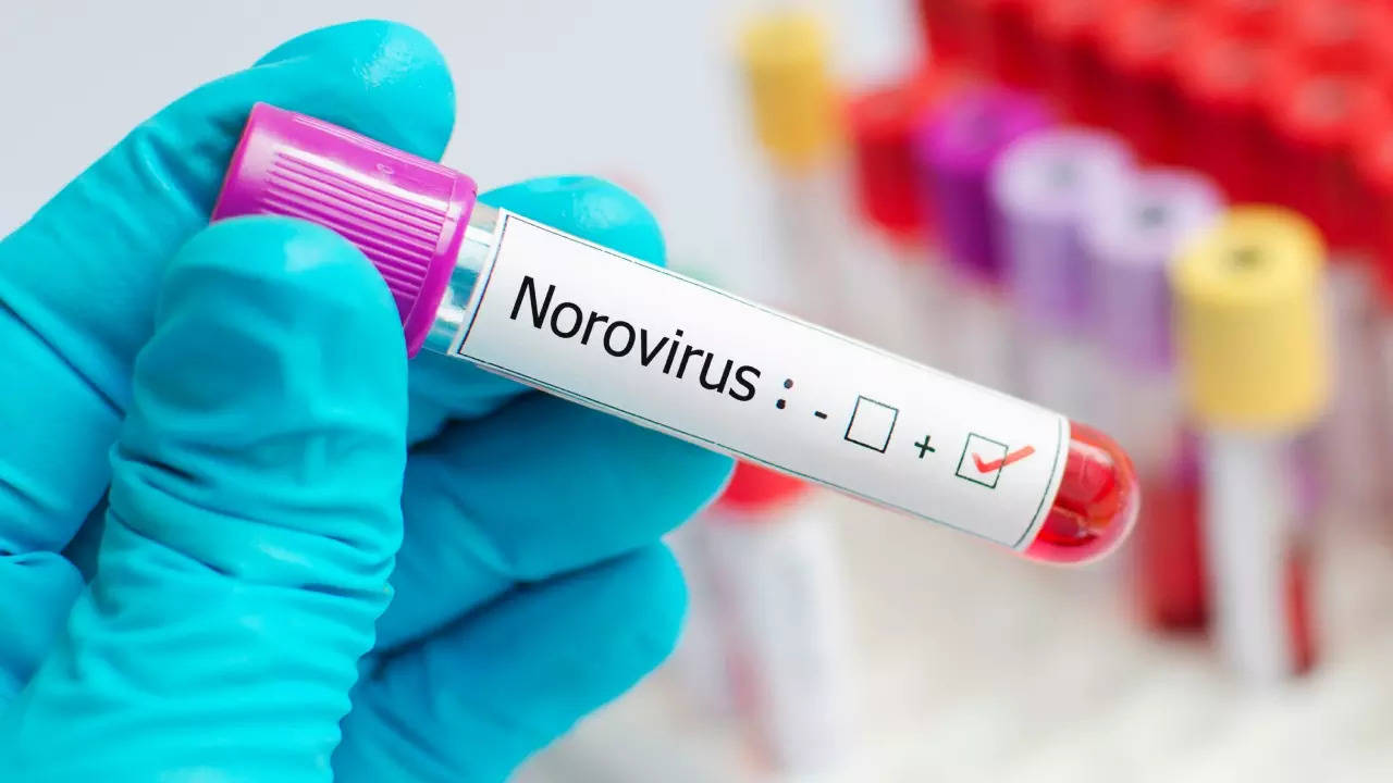 Norovirus cases surge in USA: 5 key things you need to know