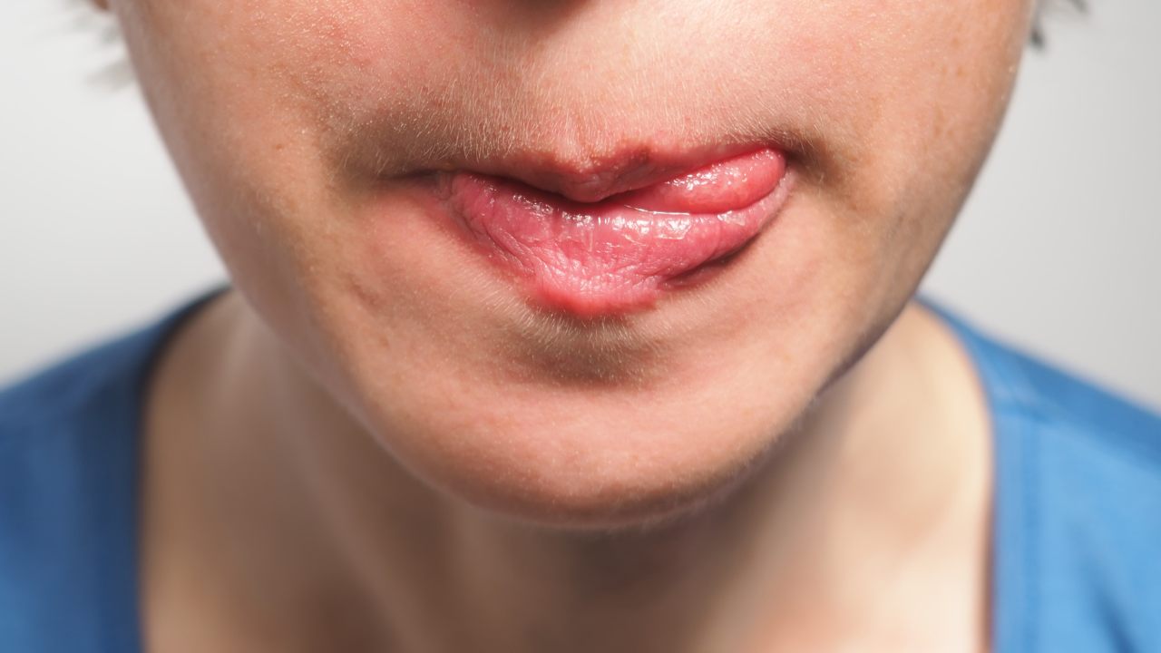 5 reasons for chapped lips other than cold weather