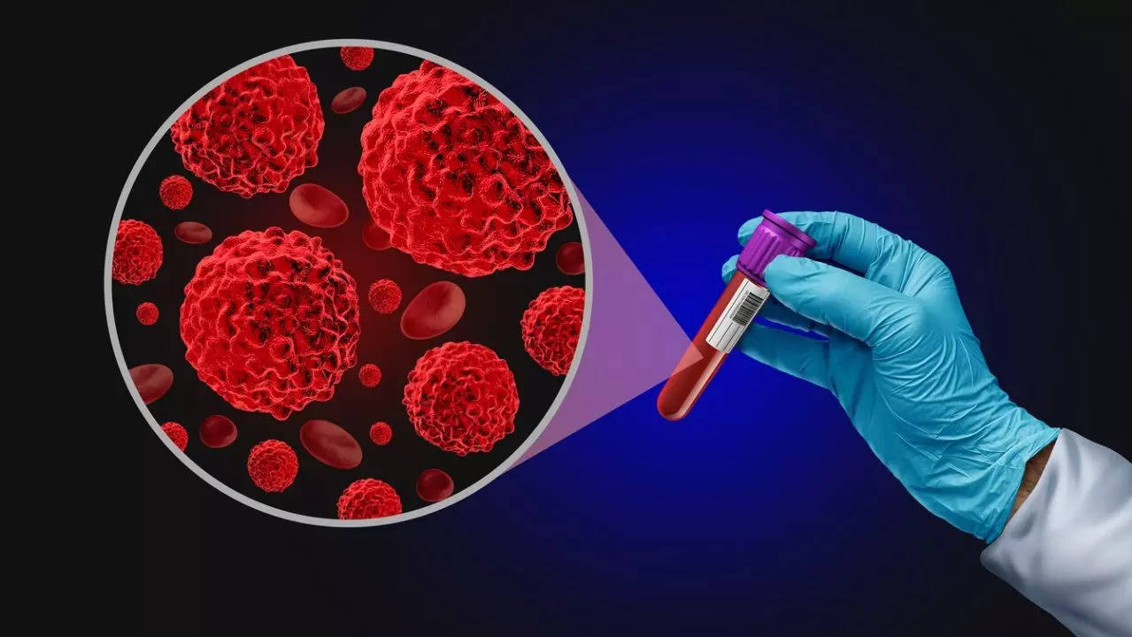 No more colonoscopy? A simple blood test detects colon cancer accurately