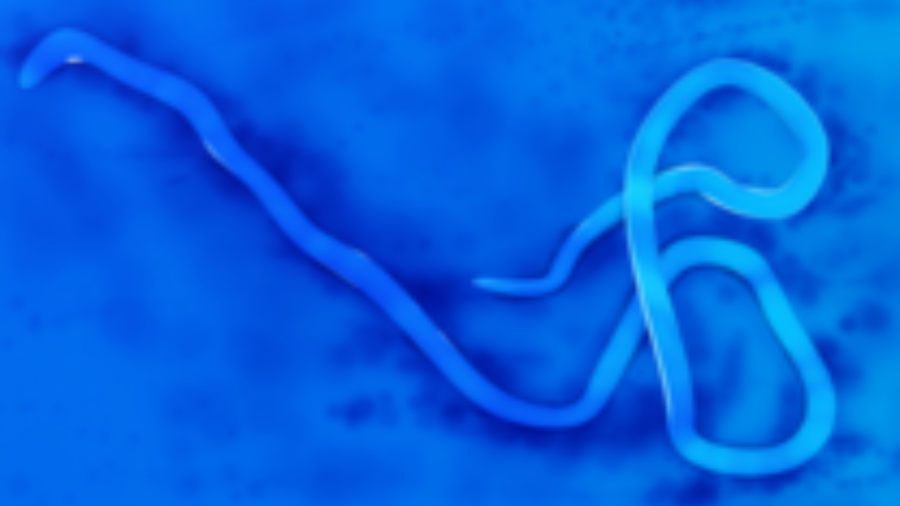 Hospital nurse dies in Uganda in first Ebola virus outbreak since 2022, health ministry says