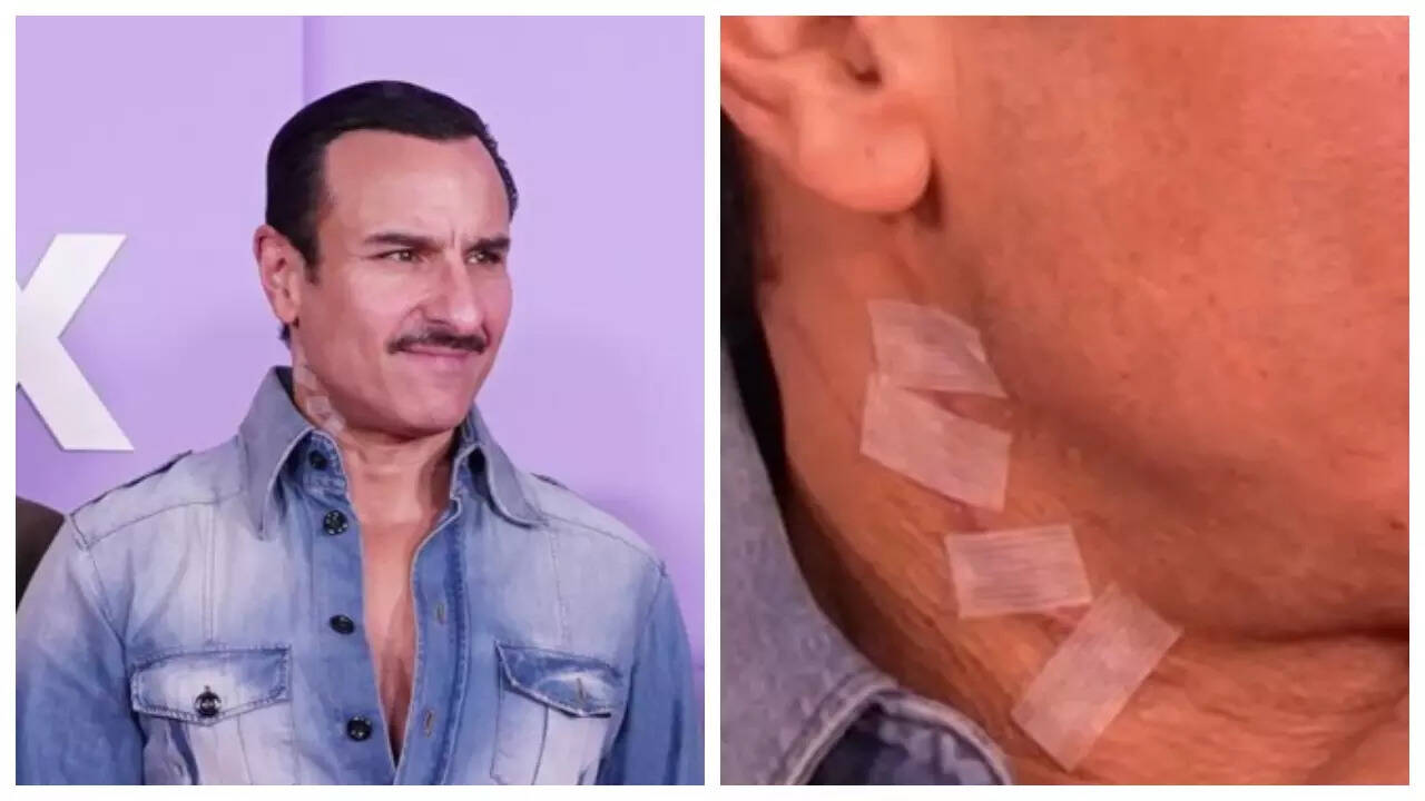 Saif Ali Khan's HUGE neck scar images go viral