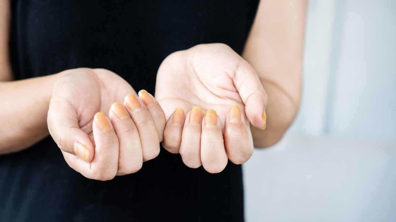 nail (1)