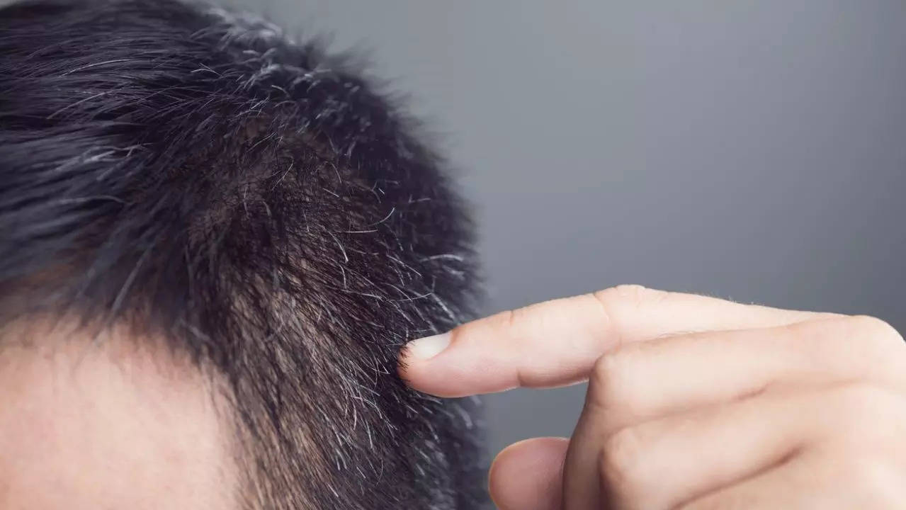 Anti-aging secret? This antioxidant can stop hair graying, discover scientists