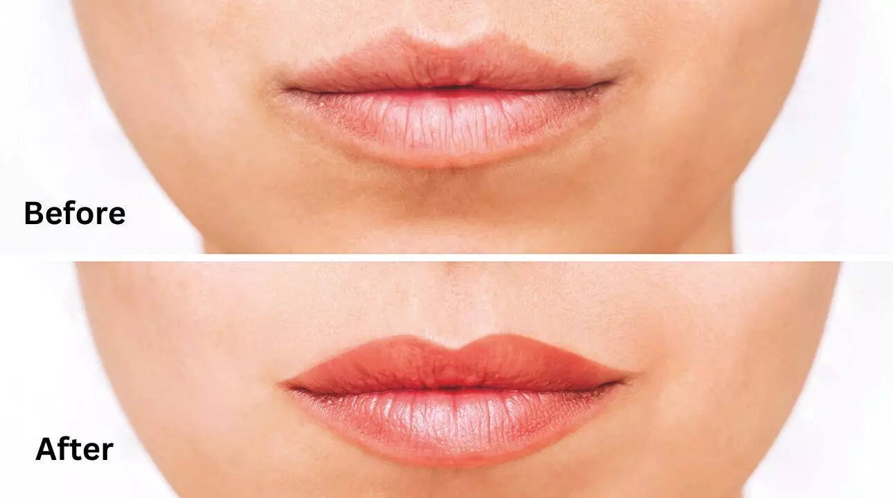 Before After image of lip tattoo treatment