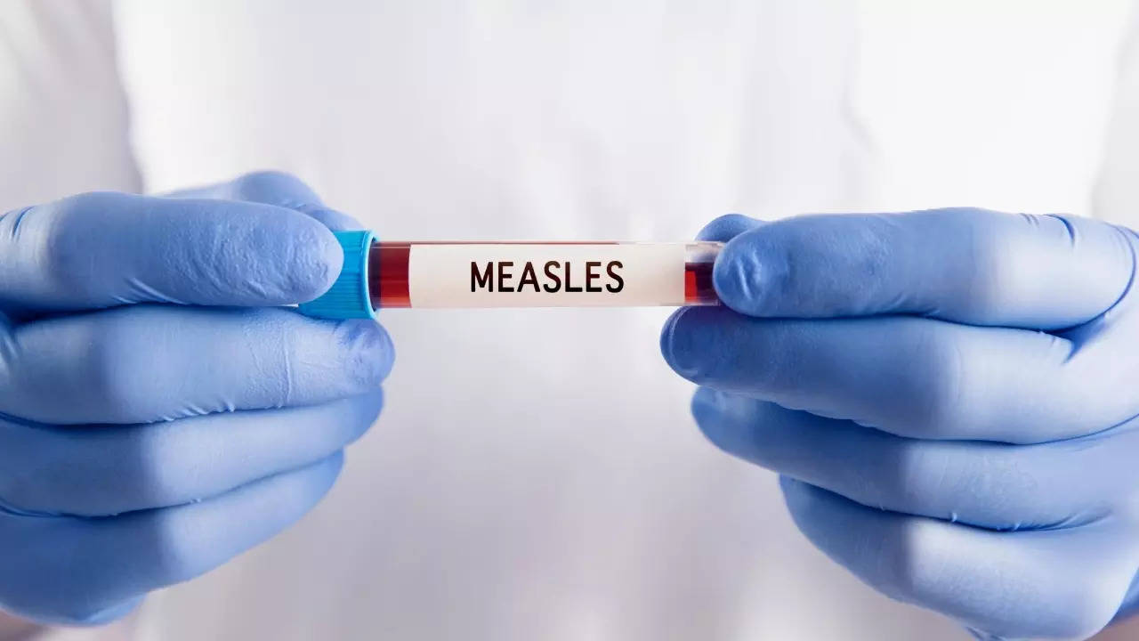 First measles death reported in Texas: Warning signs to watch out for