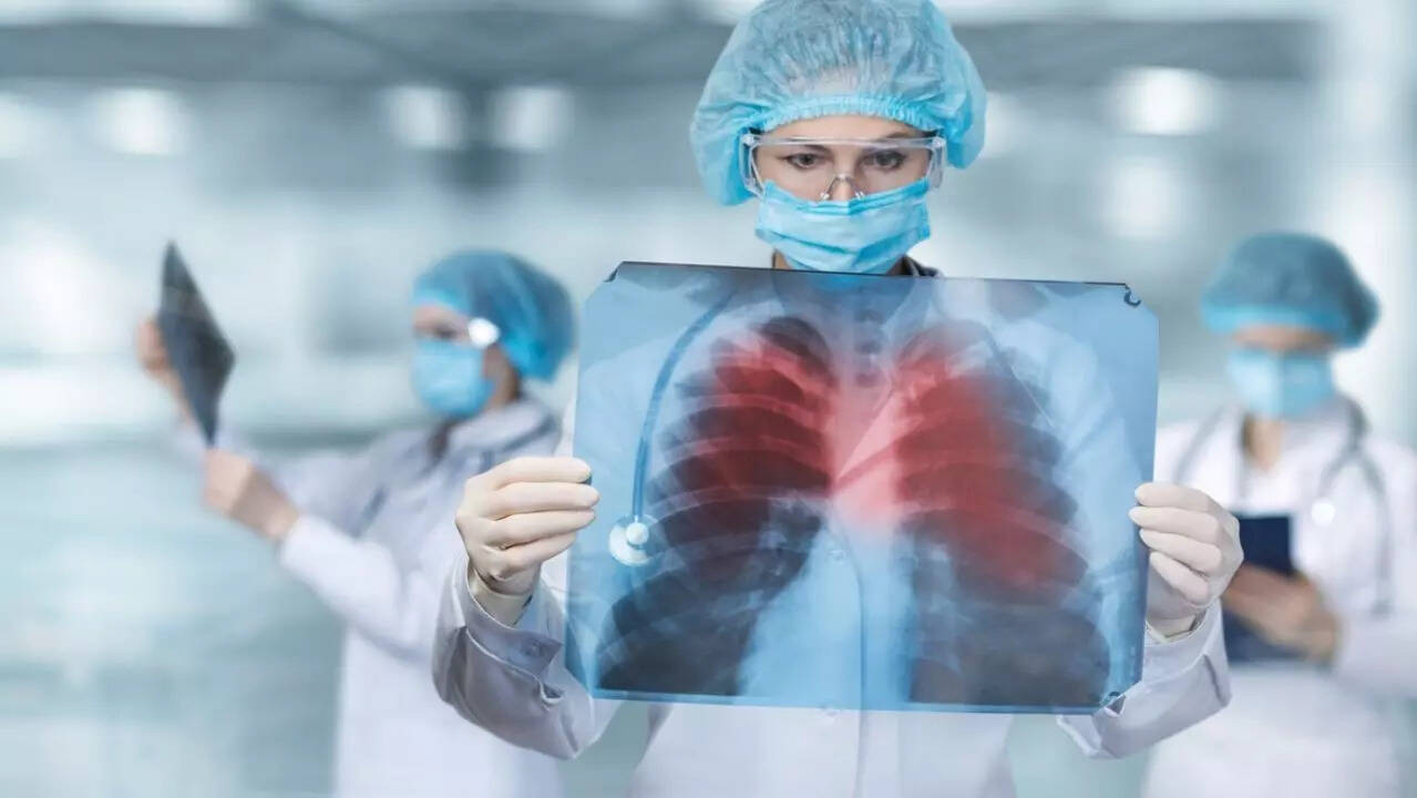 lung imaging