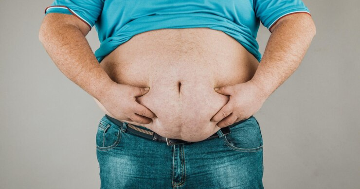 obesity