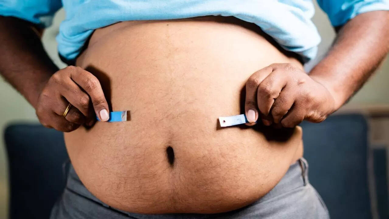 obesity 3