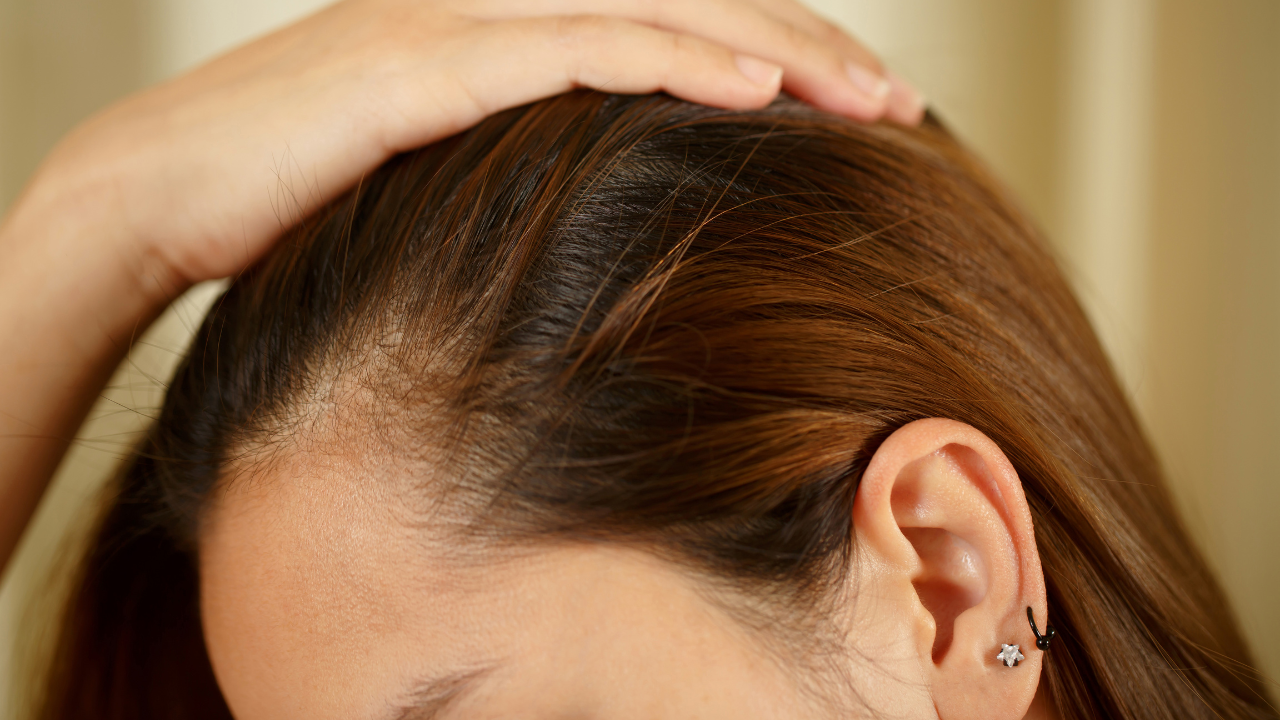 Too much hair fall? 6 internal health issues that are causing hair breakage