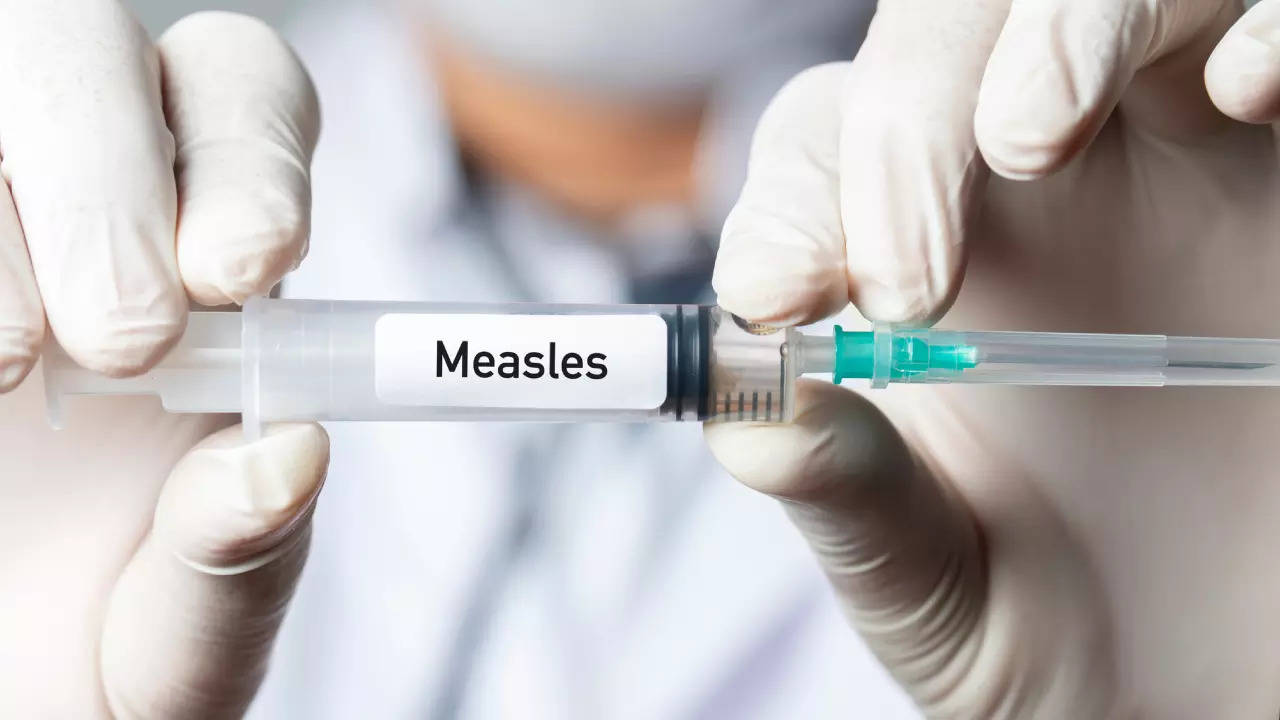 Measles on the rise in the US: Symptoms to not miss in adults