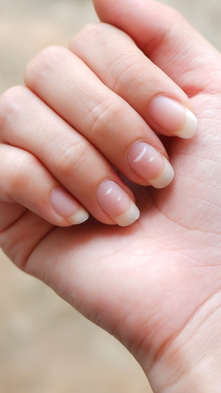 10 signs of vitamin and mineral deficiencies your nails warn you about