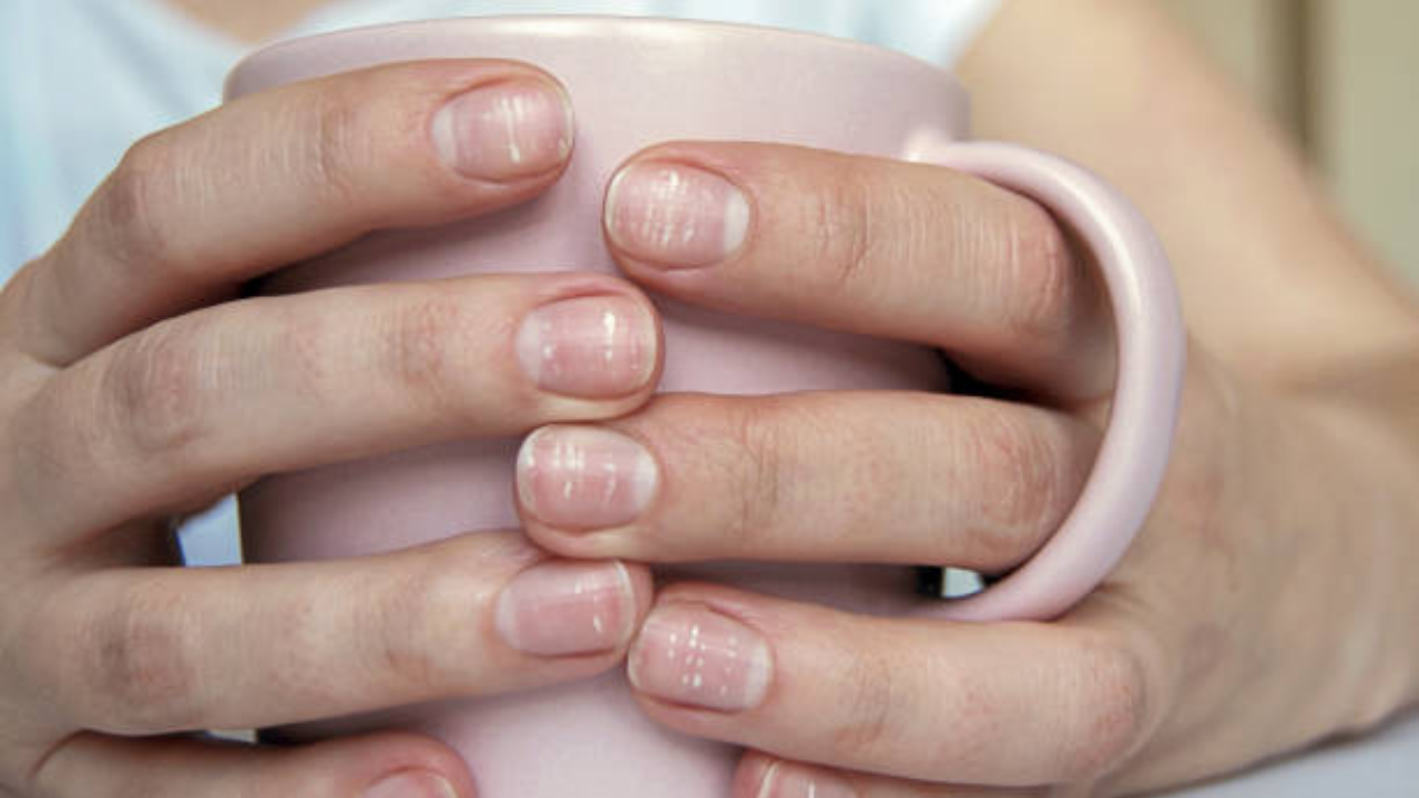 8 changes in our nails that could signal hidden disease or deficiency