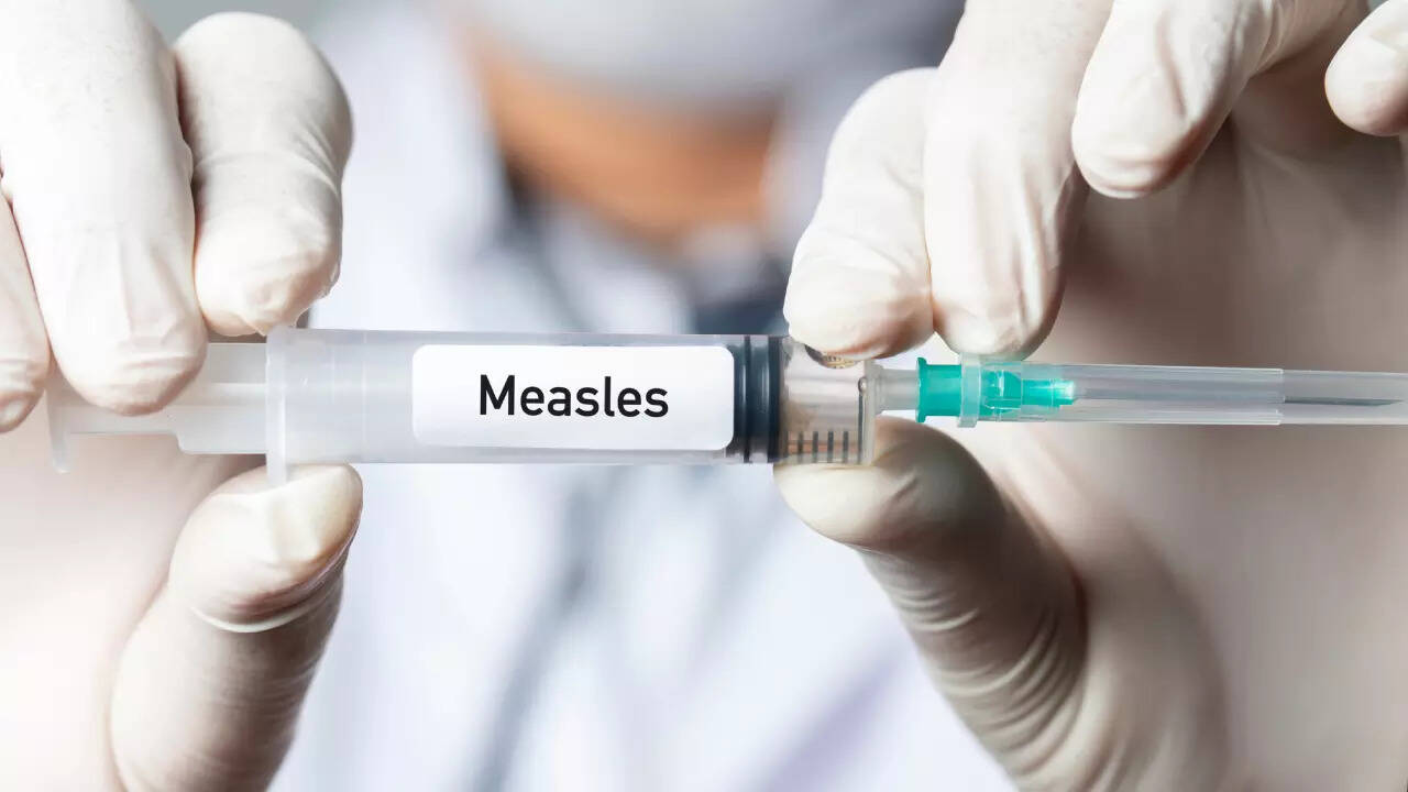 measles (5)