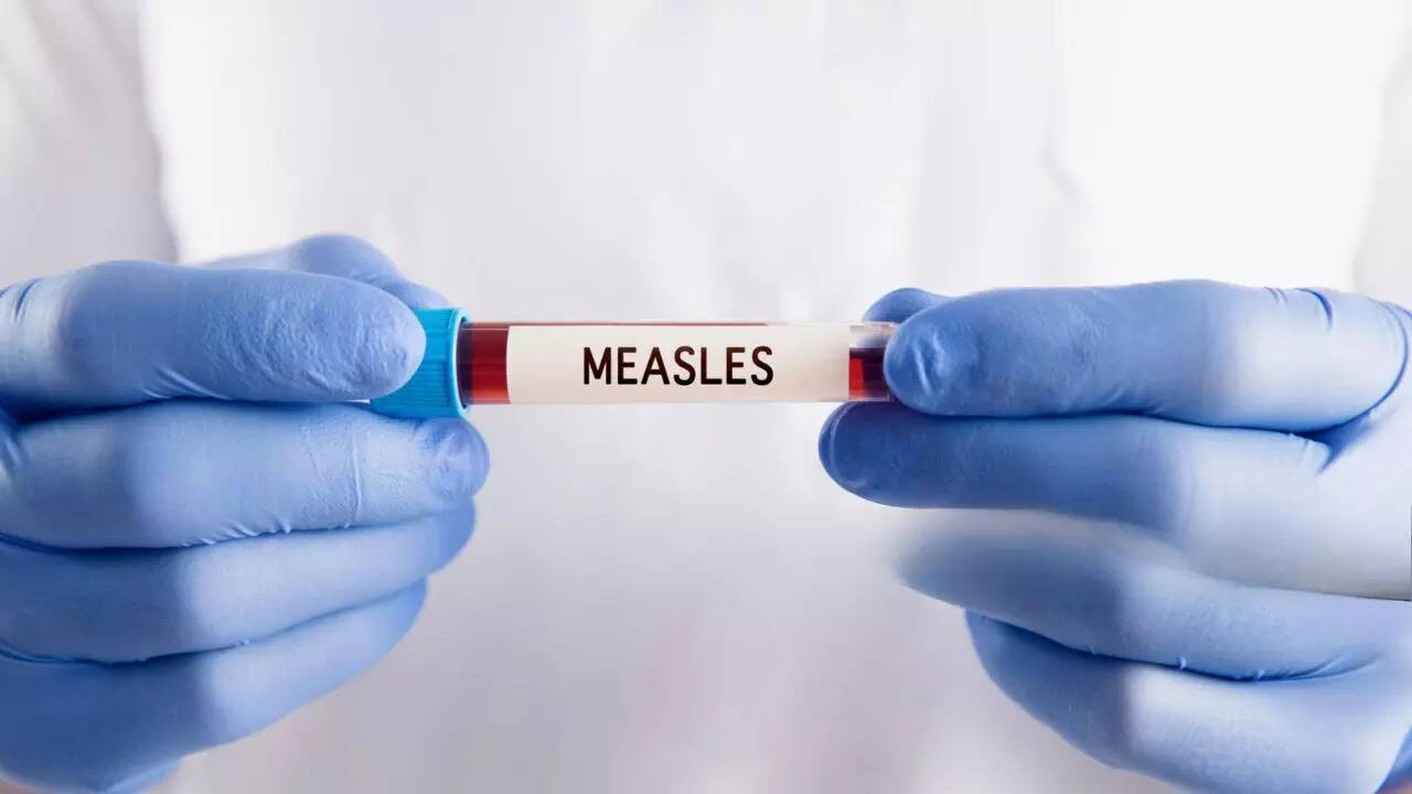 Measles case detected in Washington DC