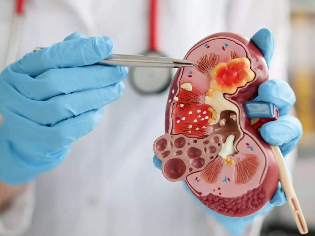 1 in 4 kids suffer from kidney problem in Andhra Pradesh & Telangana