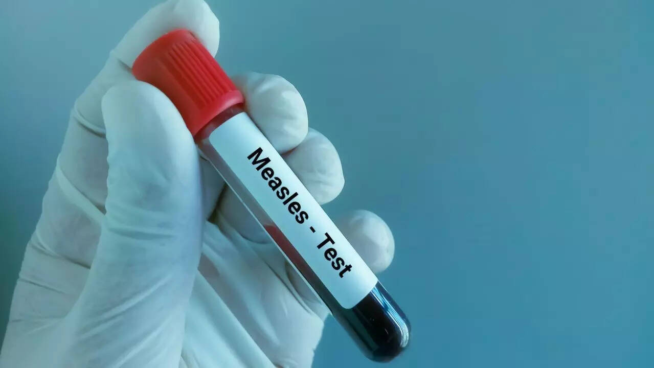 measles 2