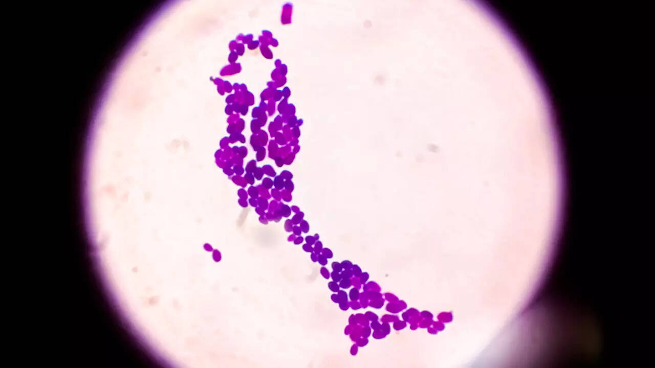 fungal