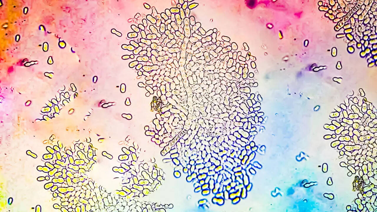 fungal