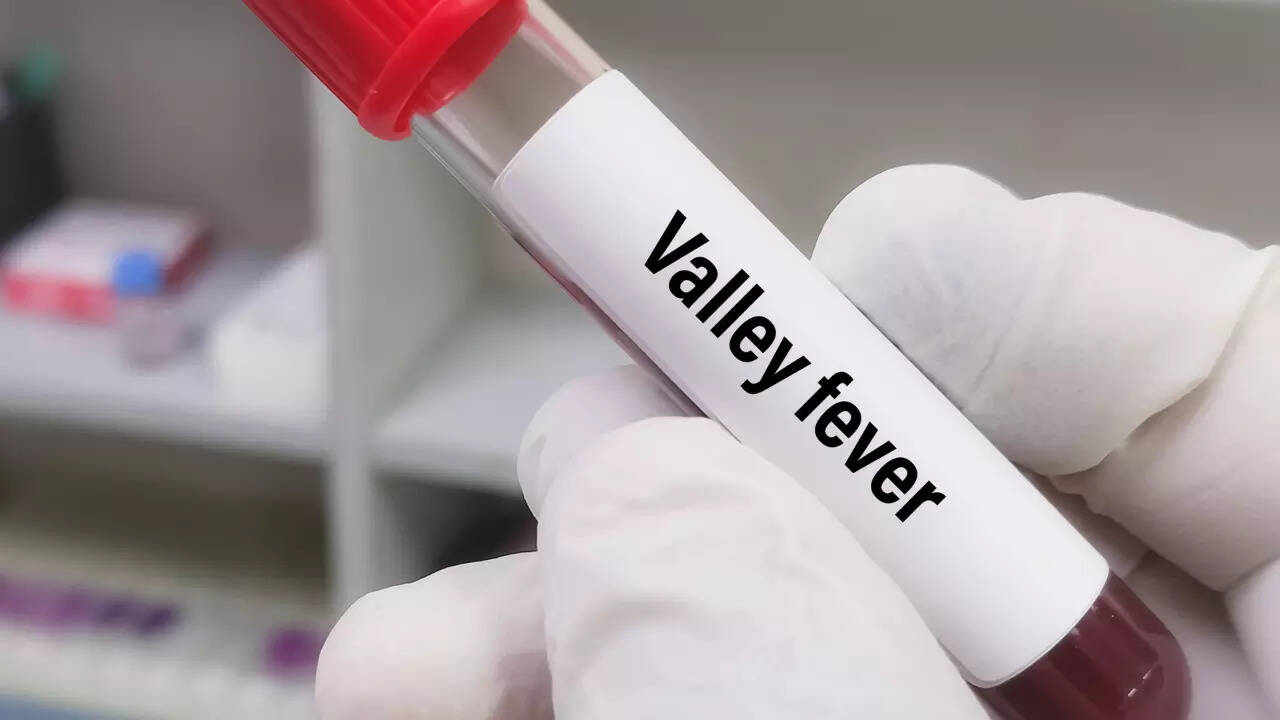 valley fever