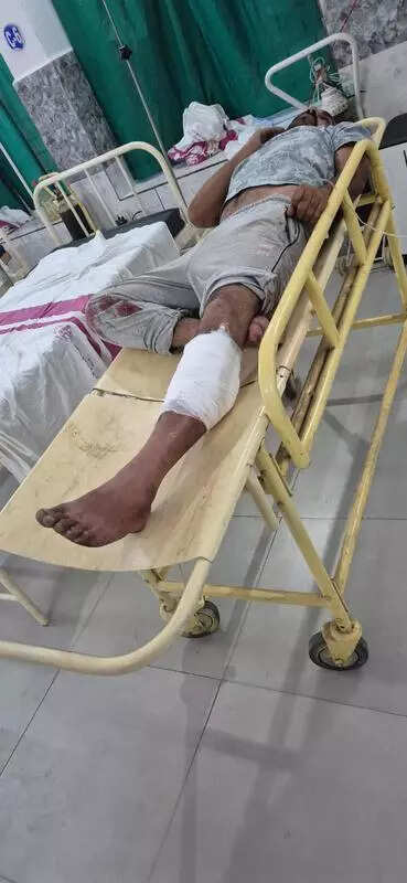 Criminal injured in cop encounter