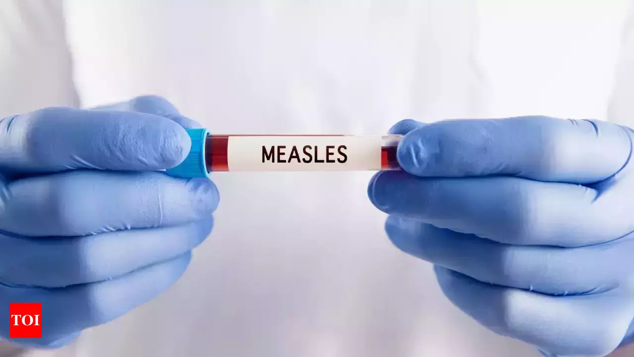 measles