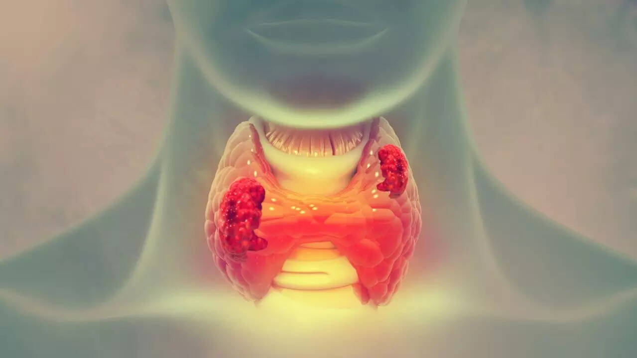 thyroid cancer