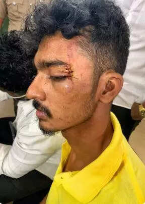 Nine city cops face action for custodial torture
